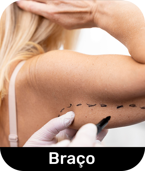 Braço