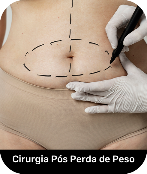 Perda de peso